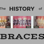Braces Through the Ages: A Historical Overview of Orthodontic Treatment